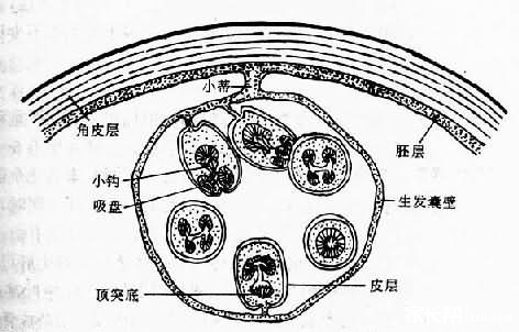 啮齿动物骨骼结构图_动物世界 棘球蚴病又称为包虫病。包虫病是人感染棘球绦虫的幼虫(棘球蚴)所致的慢性寄生虫病。本病的临床表现视包虫囊部位、大小和有无并发症而不同。长期以来,包虫病被认为是一种人畜共患寄生虫病,称之为动物源性疾病。根据近年来流行病学调查,称之地方性寄生虫病;在流行区带有职业性损害的特点,被列为某些人群的职业病;从全球范围讲包虫病为少数民族或宗教部落所特有的一种常见病和多发病。 一、病因 本病是种严重的人畜共患的疾病,我国包虫病高发流行区主要集中在高山草甸地区及气候寒冷、干旱少雨的牧区及半农半牧区,以新疆、青海、甘肃、宁夏